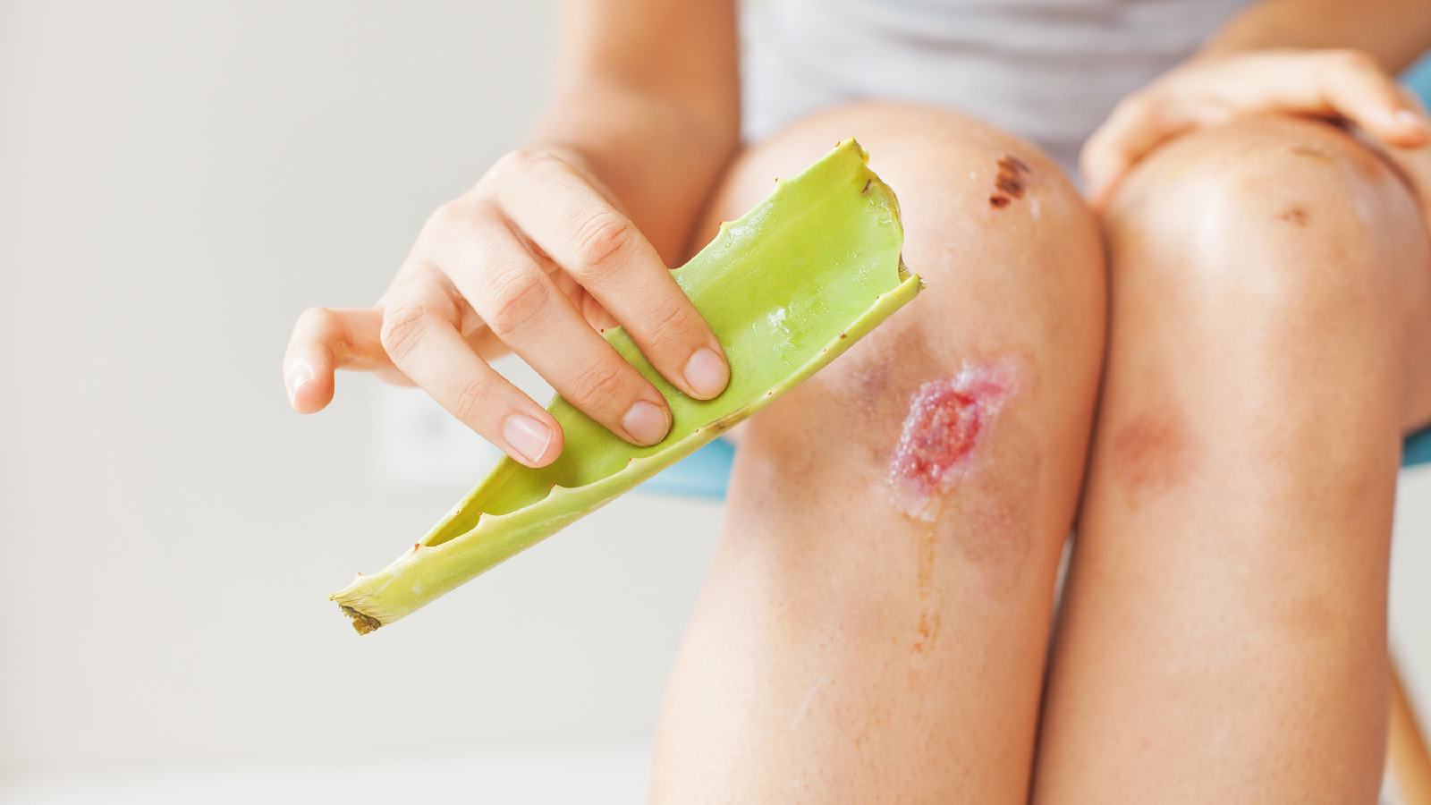 aleo vera gel for wound