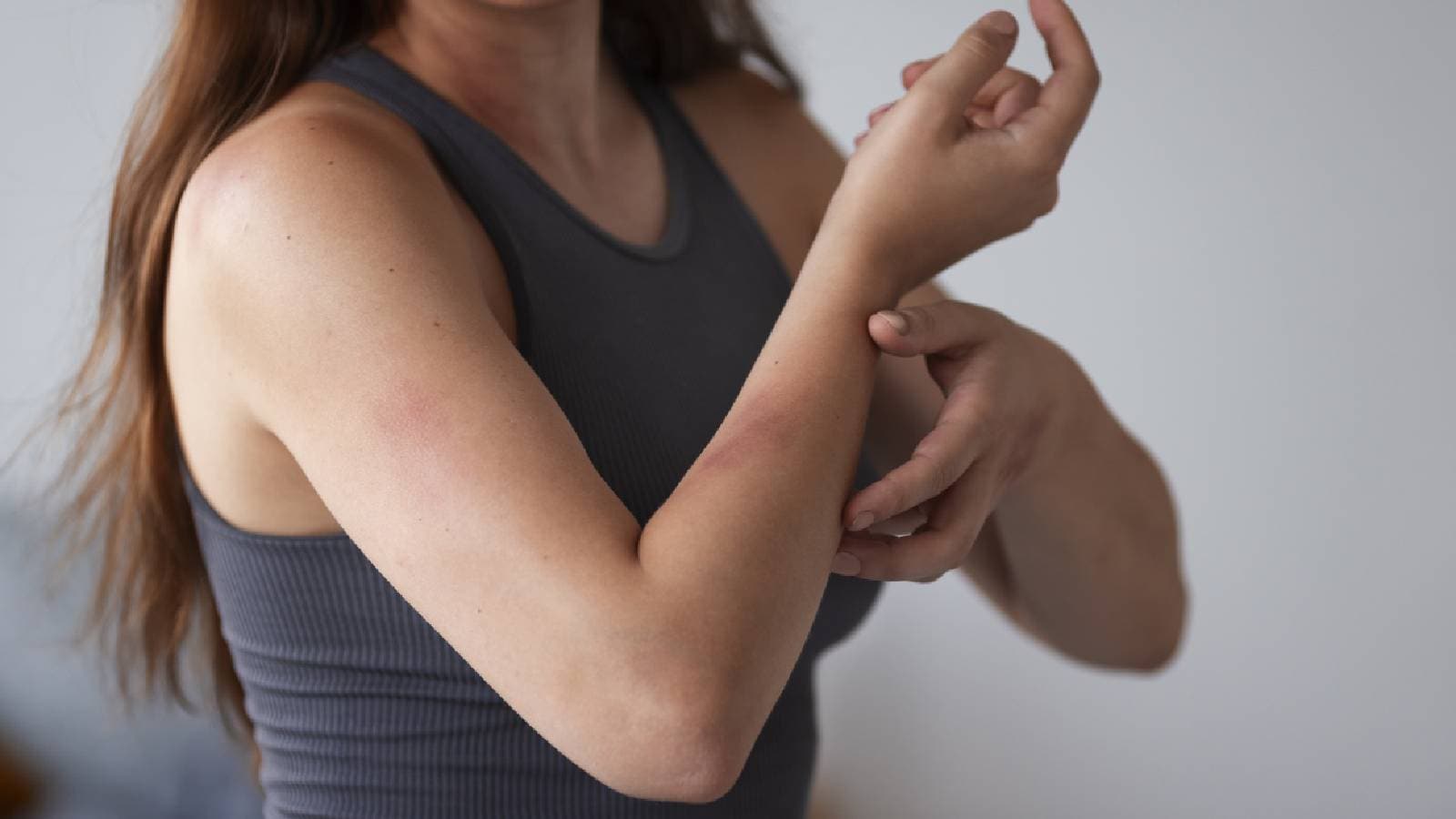 skin rash ki samasya kyu badh jaati hai