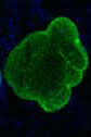 Progeria Cell