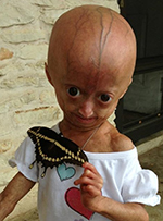 Adalia Rose