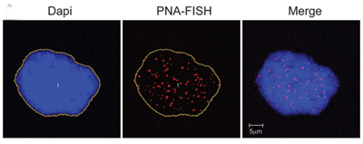 Groundbreaking Study on Progeria-Aging Link