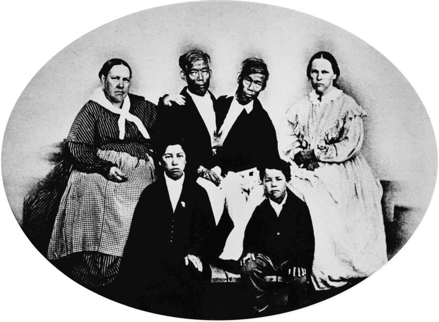 Siamese Twins With Their Wives