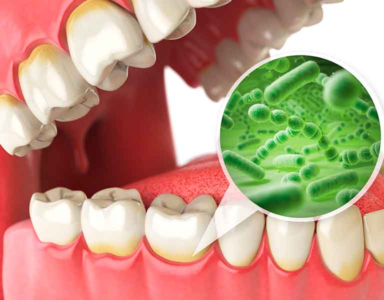 見過ごさないで!膵臓がん治療の効果を高める口腔ケアの重要性 sisyuubyou01