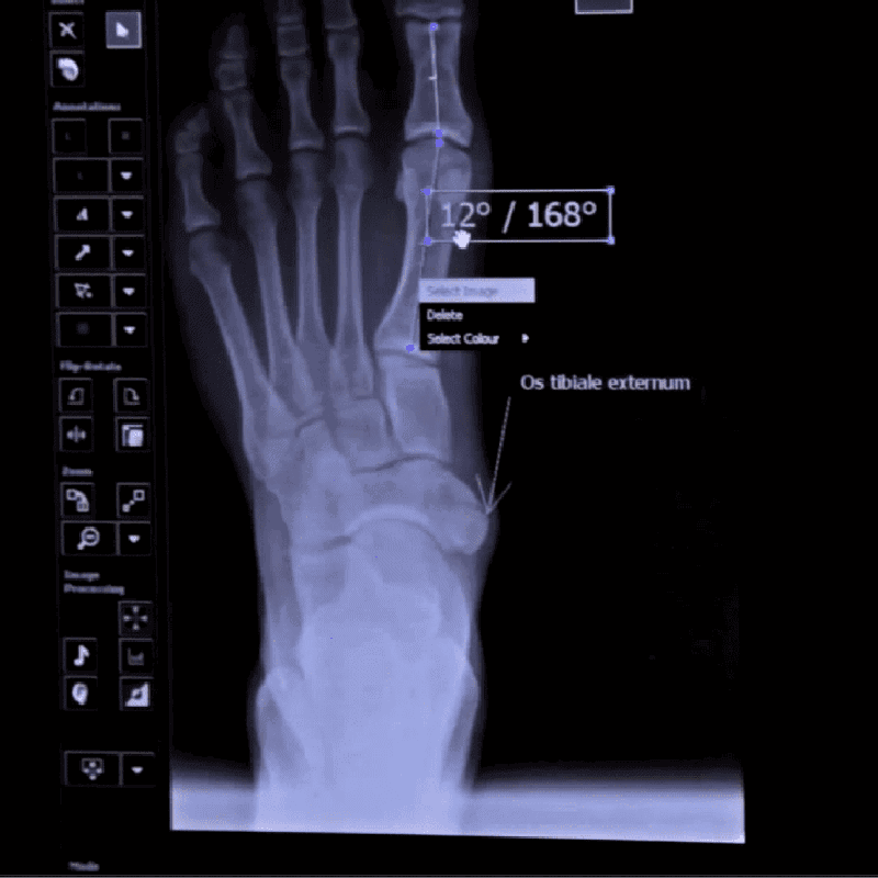 Gait & Posture image - CBJ Digital