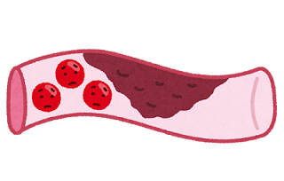 f:id:Boke-Boke:20190810224857p:plain f:id:Boke-Boke:20190810224857p:plain