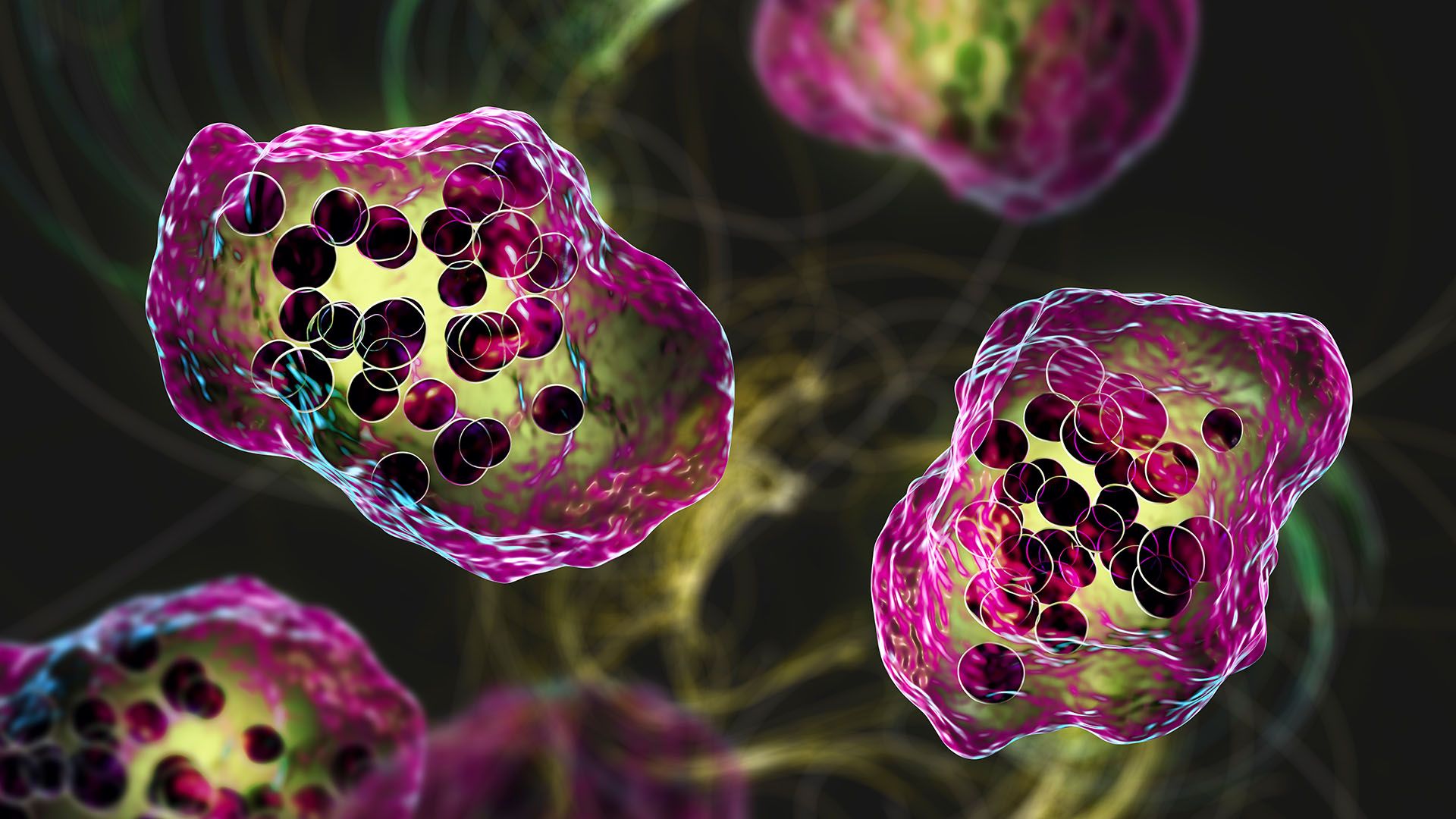 Health: South Carolina's measles outbreak nears 790 cases - cover