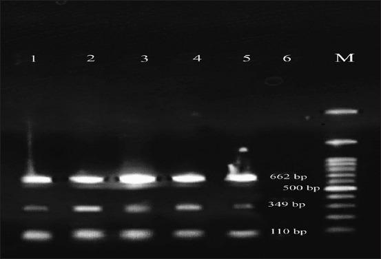 Figure-1