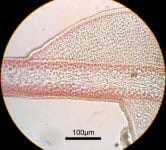 ヒロハノカクレイト