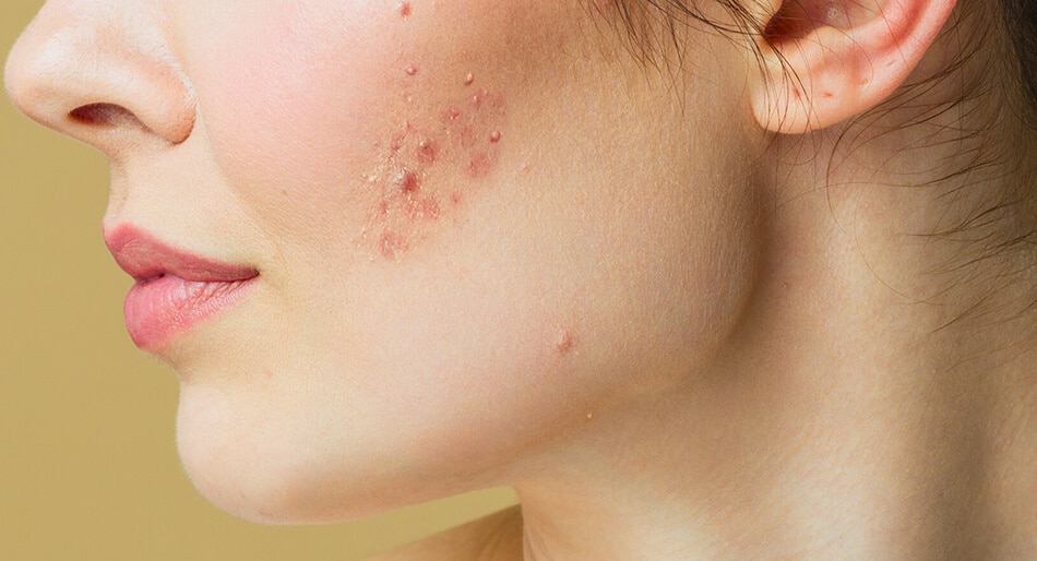 Image Comparison 10 Left Image