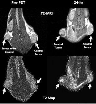 MRI_T2_Result