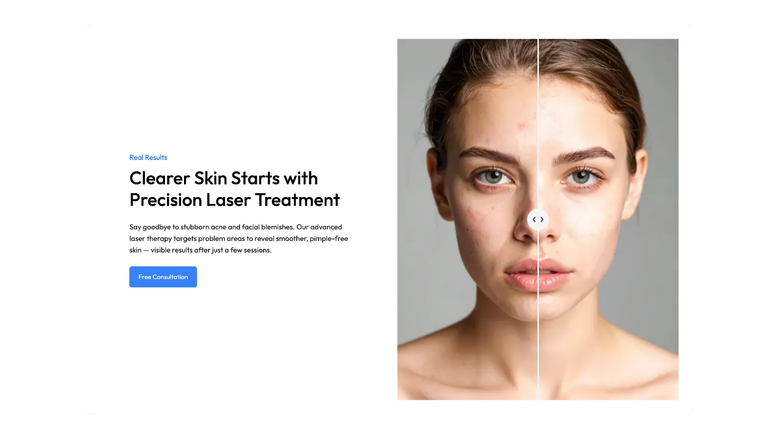 Use Image Compare Block to Showcase Facial Treatments on Your Site