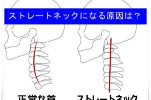 ストレートネック原因