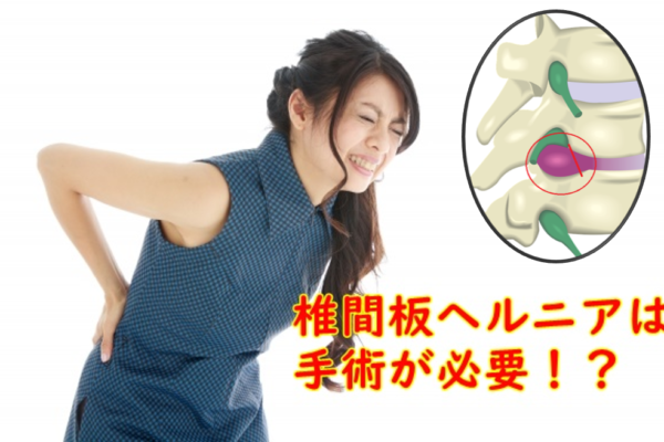 椎間板ヘルニアは手術が必要?