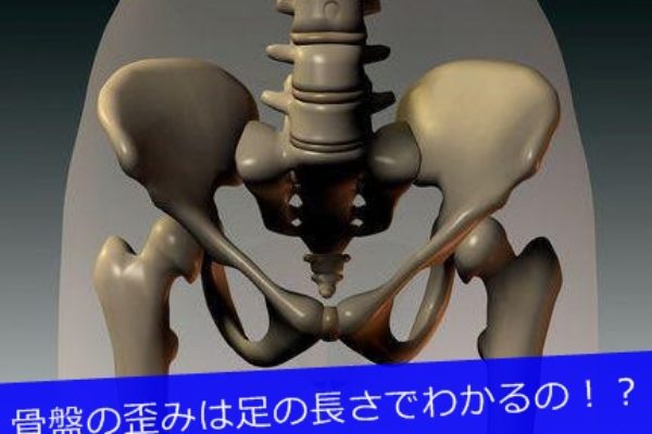 骨盤の歪みは足の長さでわかる?
