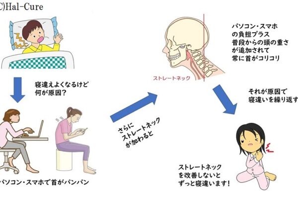 寝違えを繰り返すのはストレートネックが原因かも!?