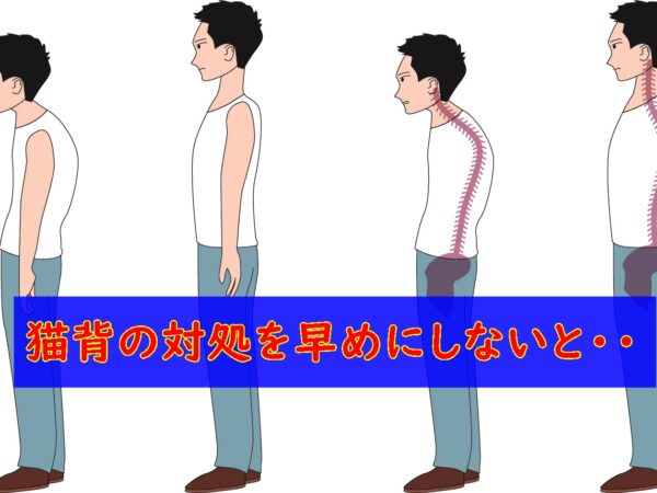 猫背は早めに対処しないと・・