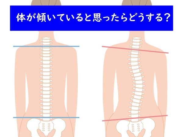 体が傾いていると思ったらすること