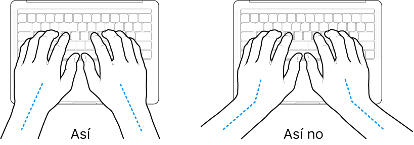 Manos colocadas sobre un teclado que muestran una alineación correcta e incorrecta de la muñeca y la mano.