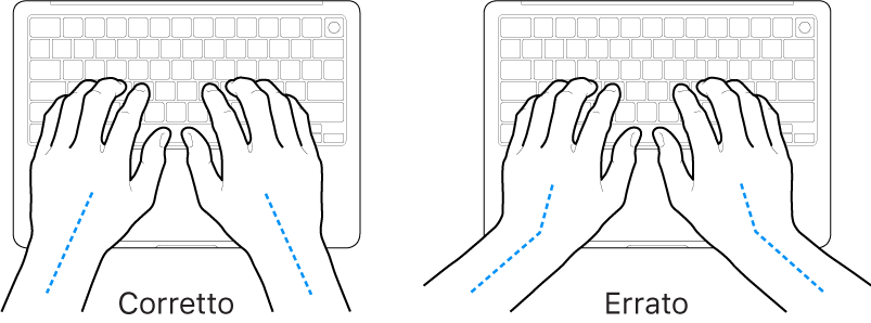 Mani posizionate su una tastiera che illustrano l'allineamento corretto ed errato di polso e mano.