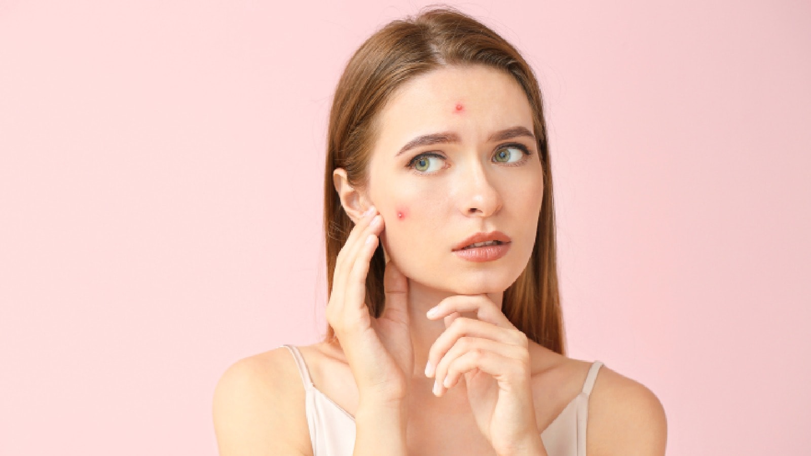 acne ki pehchan hona bhut jaruri hai
