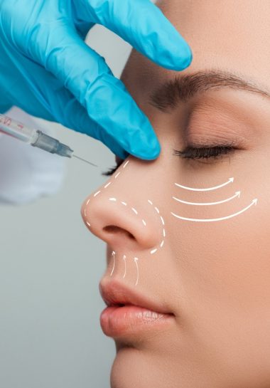 Photo of face pricked by needle during plastic surgery