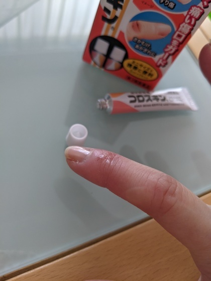 指先の傷は絆創膏ではなく、コロスキン_c0177968_11354621.jpg