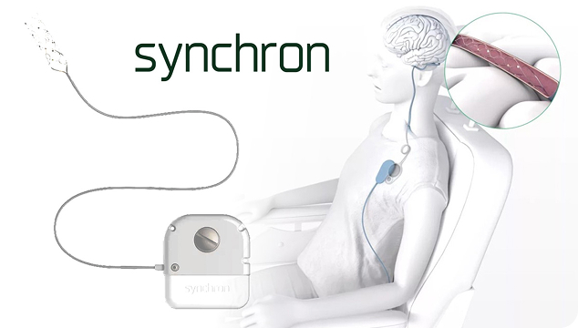 Synchron Computer Brain Interface