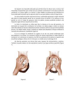 Se requiere una mascarilla adecuada que permita incluir en ella la nariz y la boca. Son
mascarillas transparentes que consta