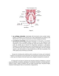 Figura 3
5. Los cartílagos aritenoides, responsables del movimiento de las cuerdas vocales,
pueden ser dañados con la