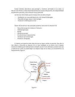 Existen distintas alternativas para proteger y mantener permeable la vía aérea. La
elección del método a utilizar dependerá