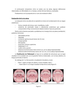 A continuación revisaremos cómo se evalúa una vía aérea, algunas definiciones
relacionadas con dificultades en su manejo y c
