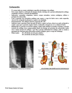 Esofagografia:
-
É o nome dado ao exame radiológico especifico da faringe e do esôfago.
-
Este exame objetiva a o