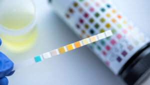 【オトコの科学】尿検査前日にオナニーしてもバレない方法8選