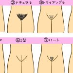 アンダーヘア種類